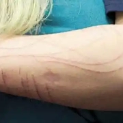 autolesionismo mio figlio si taglia