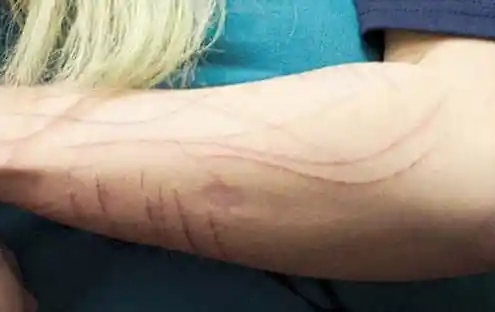 autolesionismo mio figlio si taglia