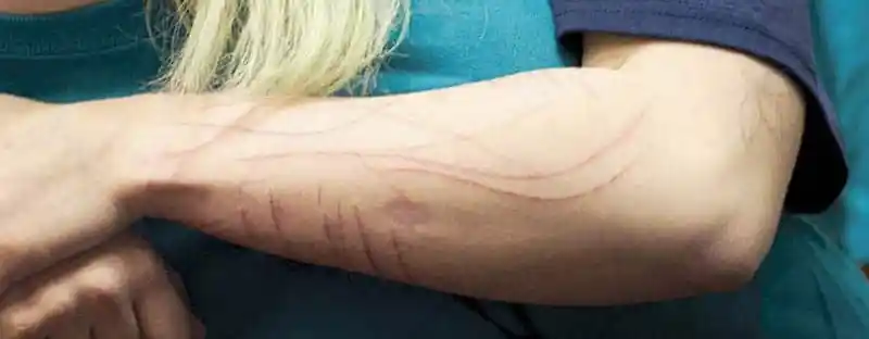 autolesionismo mio figlio si taglia