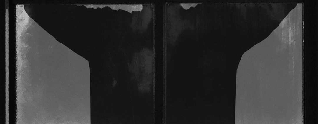 Disturbo ossessivo compulsivo nei bambini