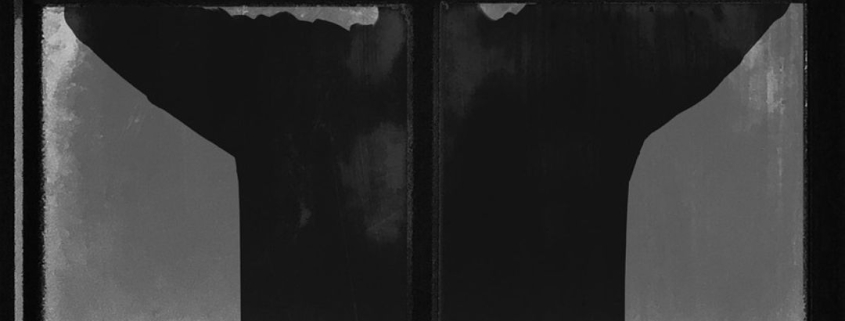 Disturbo ossessivo compulsivo nei bambini